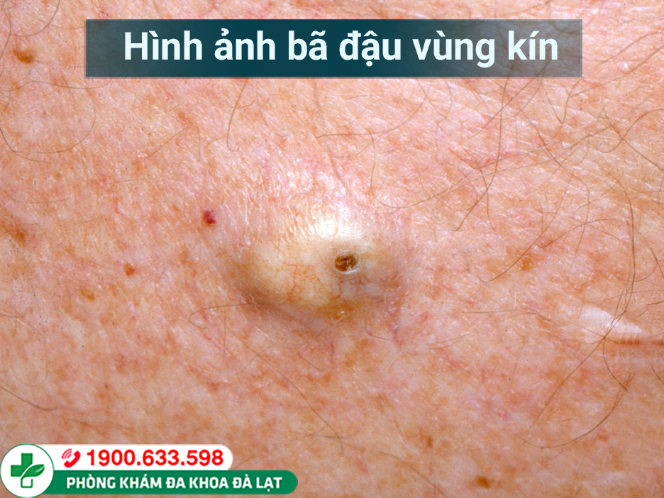 Hình ảnh minh họa